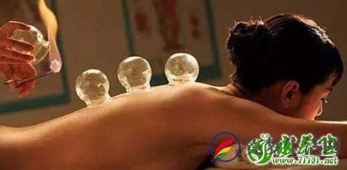 拔火罐十个注意事项 饱腹空腹都不宜拔火罐