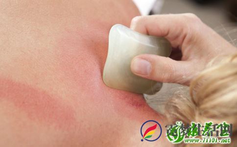 刮痧要刮哪些部位 刮痧要注意哪些事情 刮痧为什么可以缓解不适