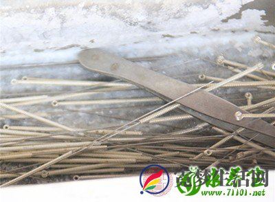 针灸的注意事项 针灸时不要做这些事情