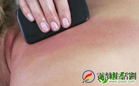 刮痧后不同的痧象都代表了什么