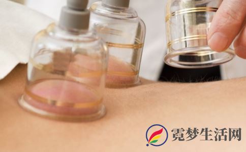 拔罐减肥有效果吗 怎么拔罐能减肥 拔罐减肥注意什么
