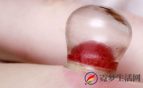 拔罐足三里的功效与作用 足三里如何拔罐 拔罐足三里的作用