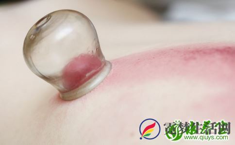 拔罐后皮肤颜色代表什么 拔罐注意什么 从罐印颜色怎么看体质