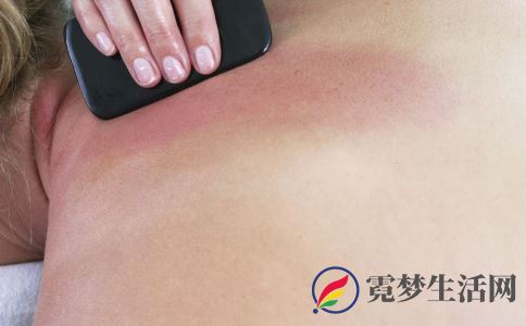 刮痧要用力吗 哪些情况不能刮痧 怎么刮痧才好