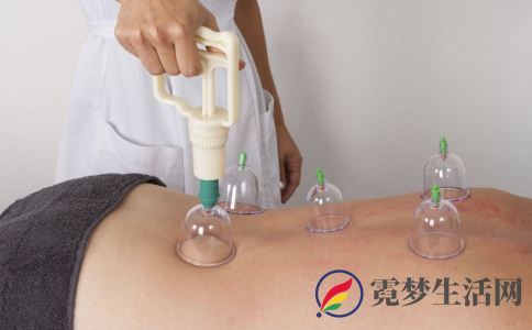 拔罐要注意什么 拔罐颜色跟什么有关 拔罐可以治疗什么
