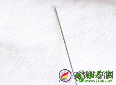 针灸治疗过敏性鼻炎为WHO推荐疗法